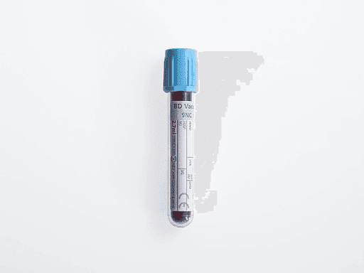 Veyon 离心机在临床检验与诊断中的应用场景 - 蔚雨生物